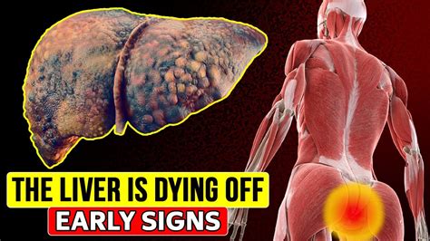 The Heartbreaking Reality: Early Warning Signs of a Failing Liver